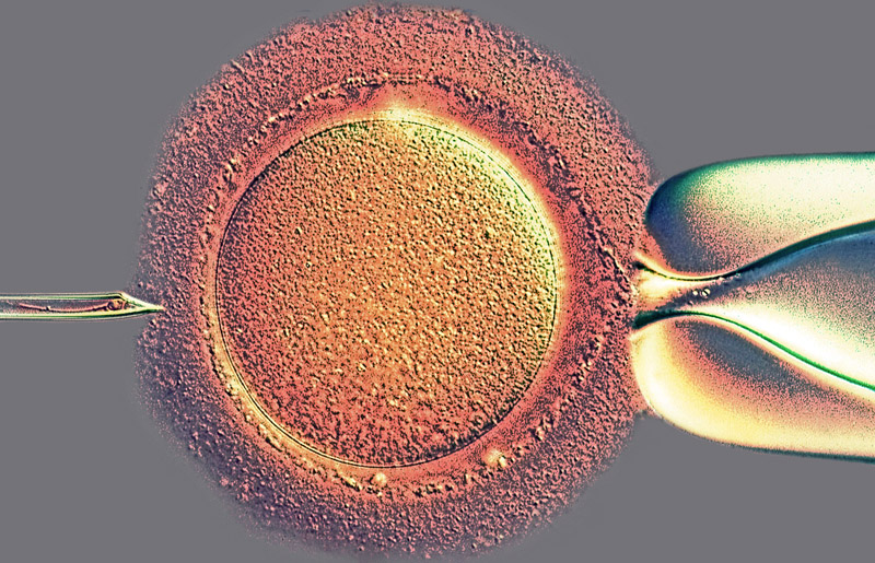 Intracellular Sperm Injection (Spike Walker ASIS FRPS)