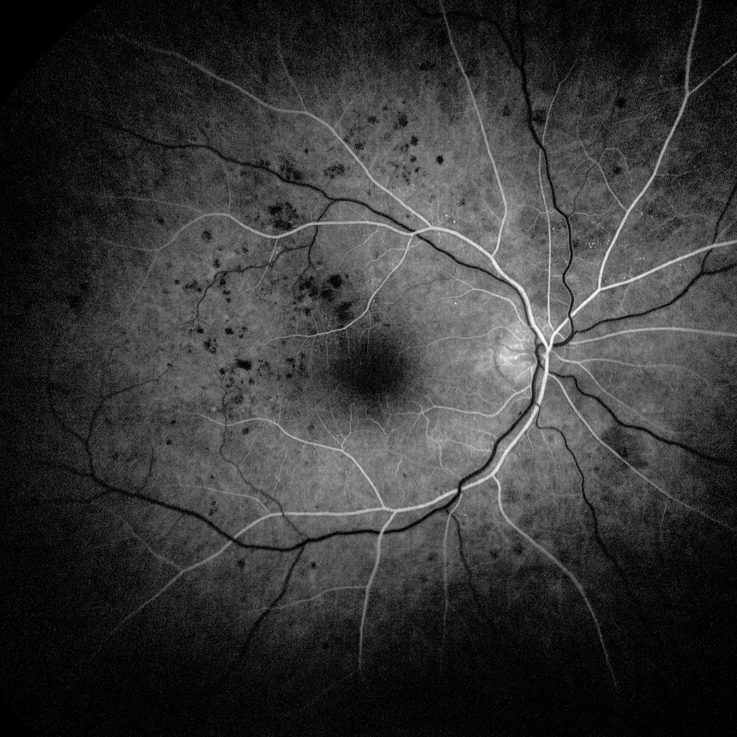 3044177 40 Shortlisted Right Eye Ffa By Hollie Pain