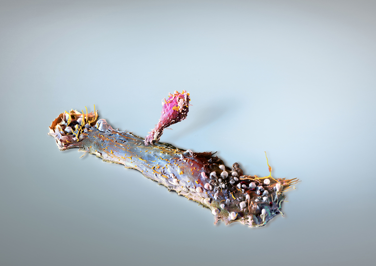 © Micronaut Cancer Immunotherapy 447003A022big2 BIG