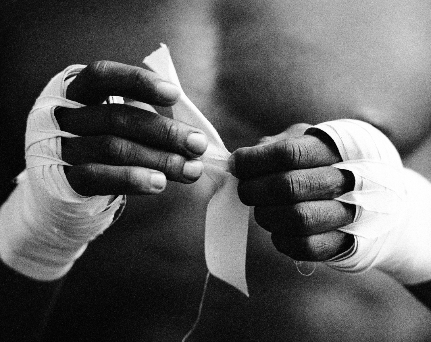 Boxer's Hands