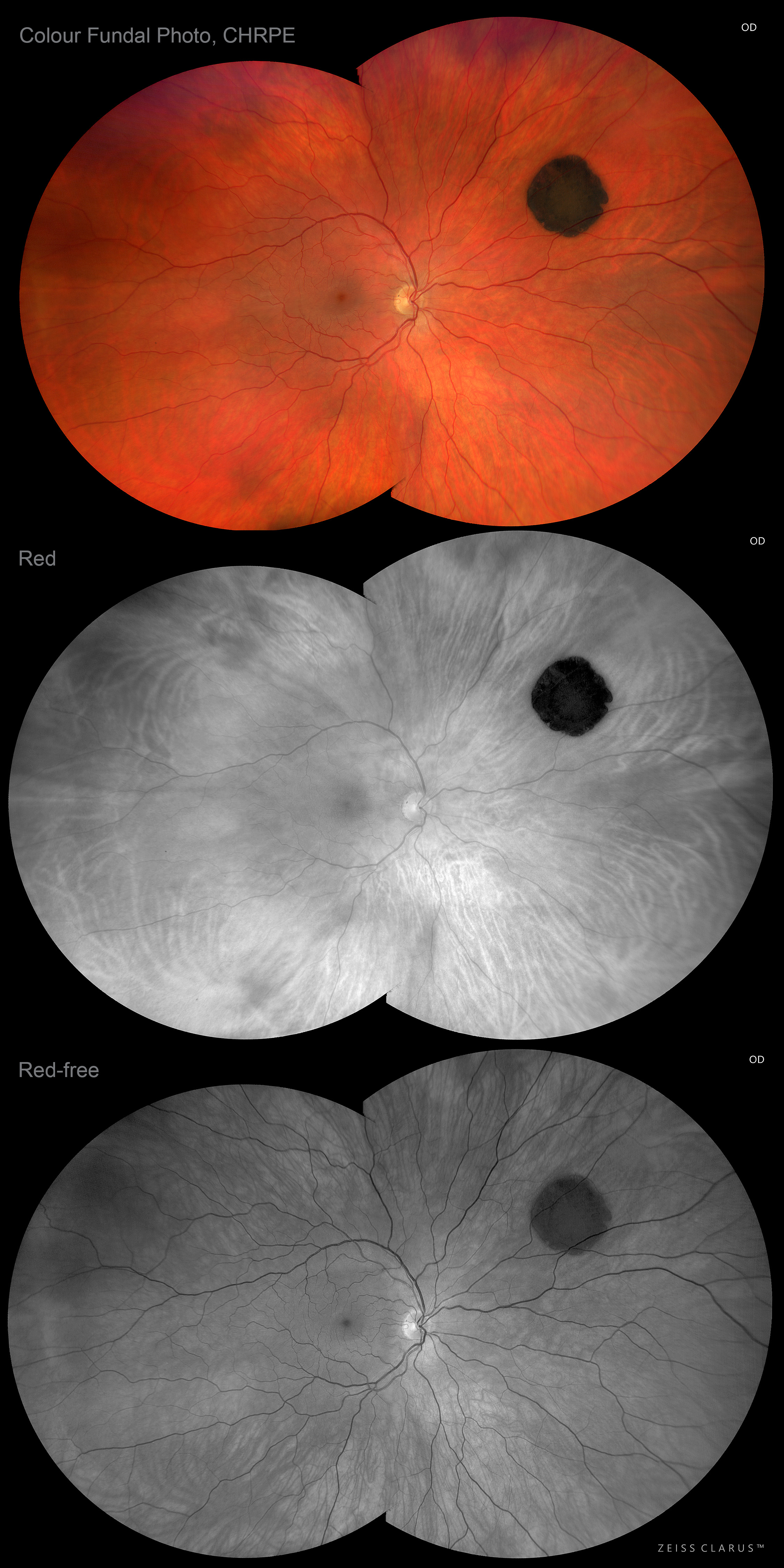 3044230 34 Shortlisted 2022 Chrpe Uwf Fundal By Amanda Rebbechi